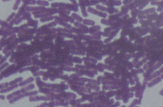 Bacillus thuringiensis jako naturalny wróg